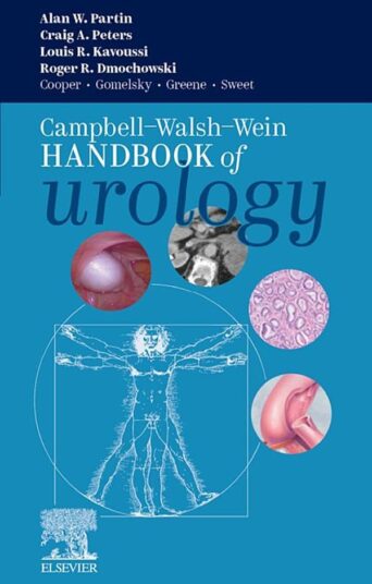 Campbell Walsh Wein Handbook of Urology 1st Edition